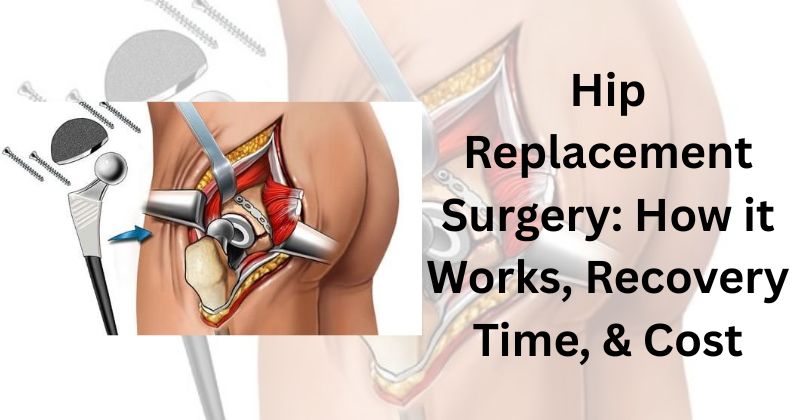 Hip Replacement Surgery